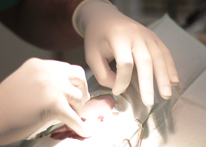 Χειρουργική επέμβαση στείρωσης