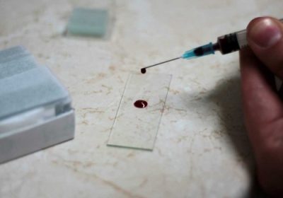 test-knott-antikeimenoforos-plaka-500x443